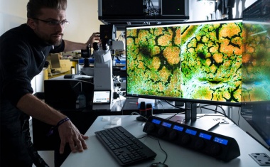 Schnelle Biopsie mit optischen Technologien