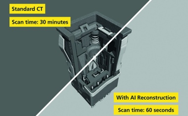 Deep Learning für schnelle und zugleich hochwertigere CT-Bilder