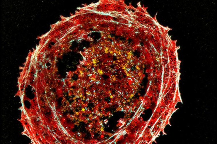 The image shows tiny membrane structures of fixed multicolor-stained liver...