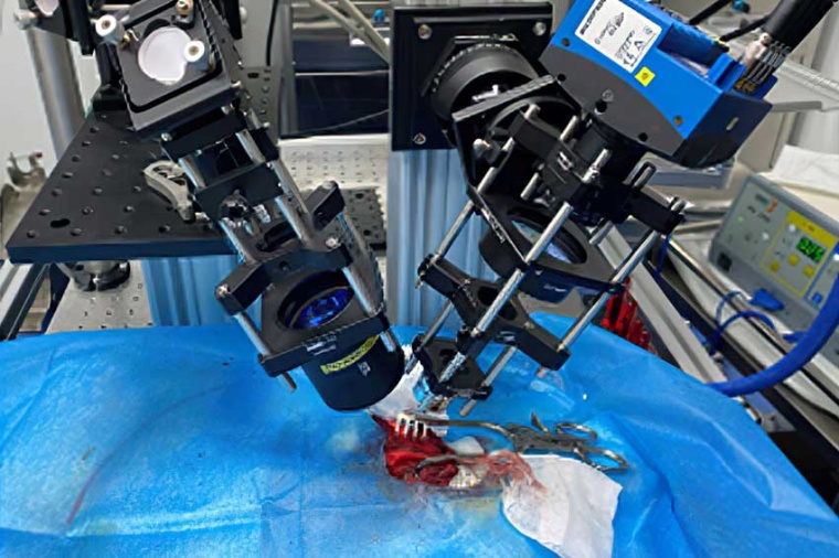 Experimental setup of the imaging system which enables the measurement of blood...