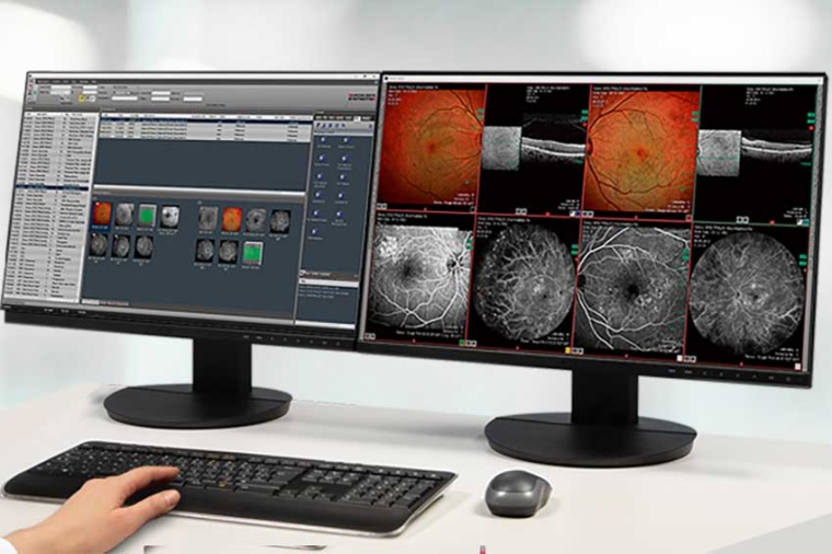 Heidelberg Eye Explorer (Bild: Heidelberg Engineering)
