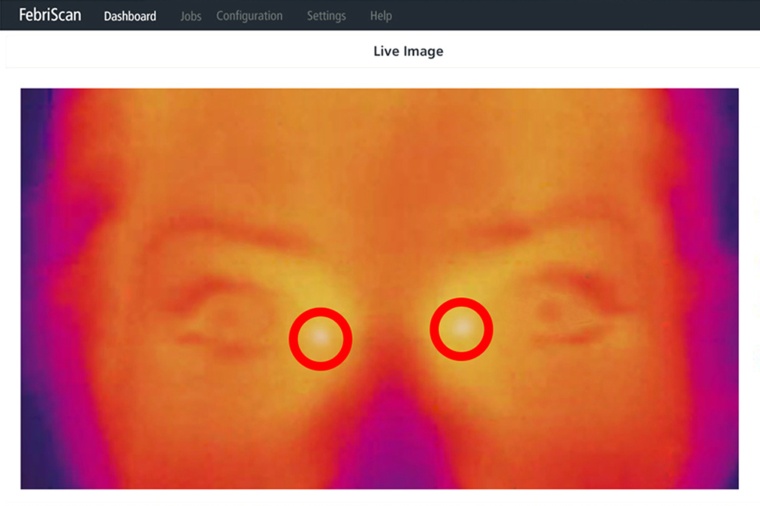 The inner corners of the eyes are the warmest areas in the human face. (Image:...