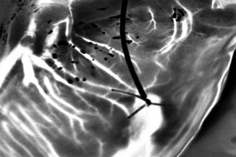 A powerful tool for imaging donor hearts, laser speckle captures detailed...