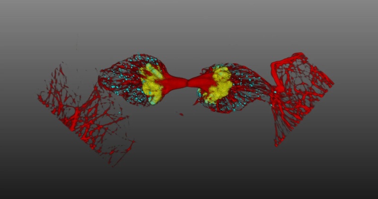 The detection and analysis of rare events in biological samples is relevant in...
