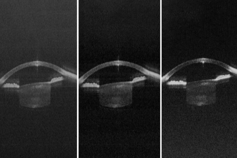 A vertical cavity surface emitting laser (VCSEL) diode could offer a less...