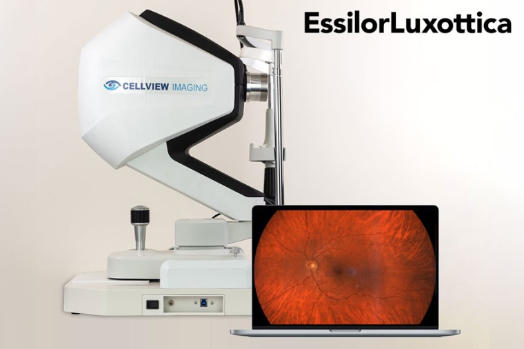 WRI-1 lets operators examine the retina and far into the periphery (Source:...